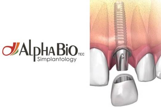 Установка имплантата системы Alpha Bio (Израиль)